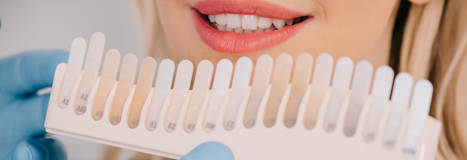 Teeth whitening color chart